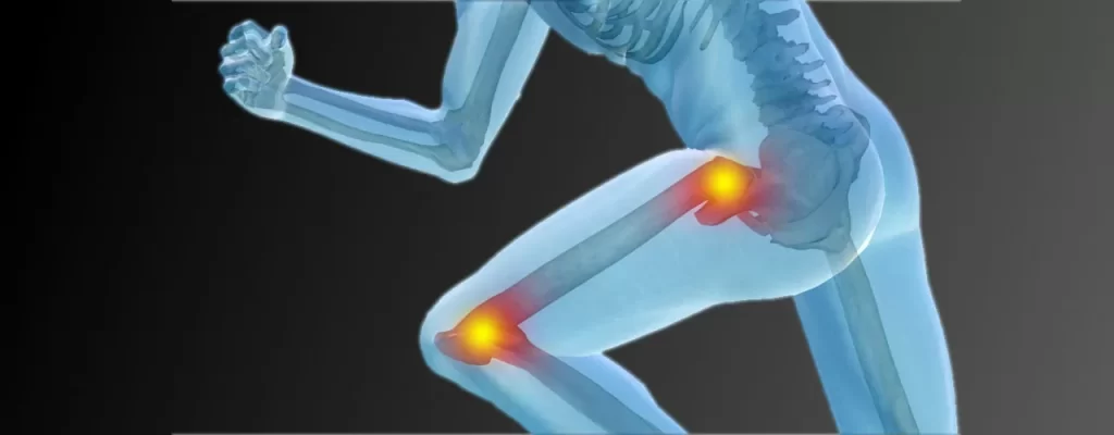 Hip and Knee Pain