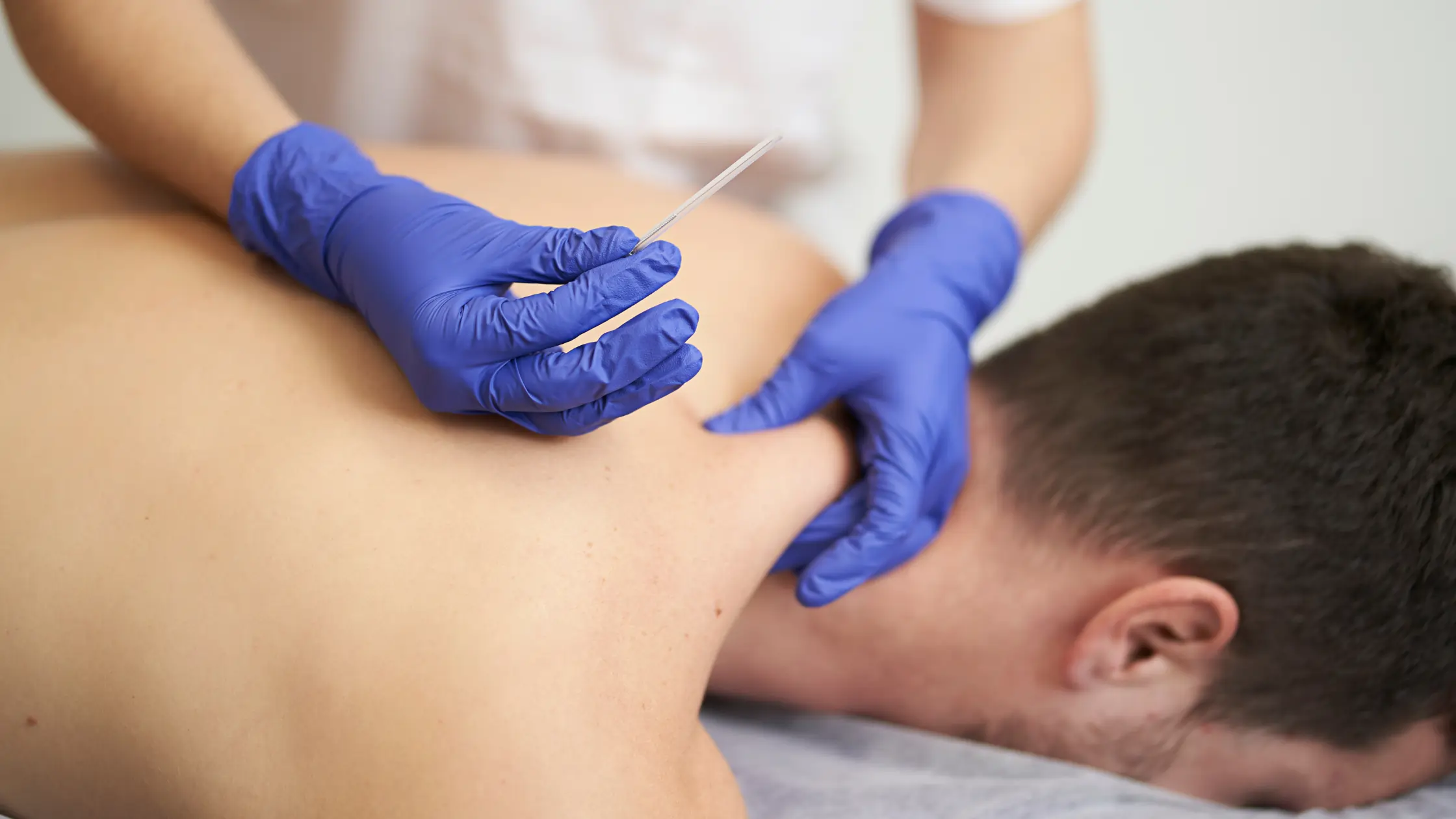 Dry Needling Physical Therapy